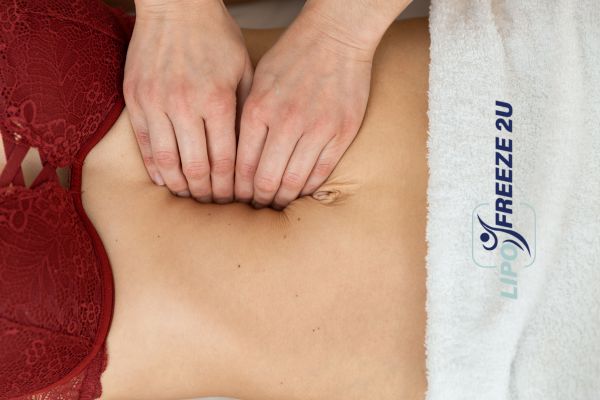 diastasis recti treatment Ellesmere Port