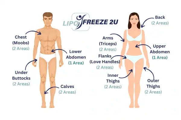 Areas you can have fat freezing treatment Ellesmere Port