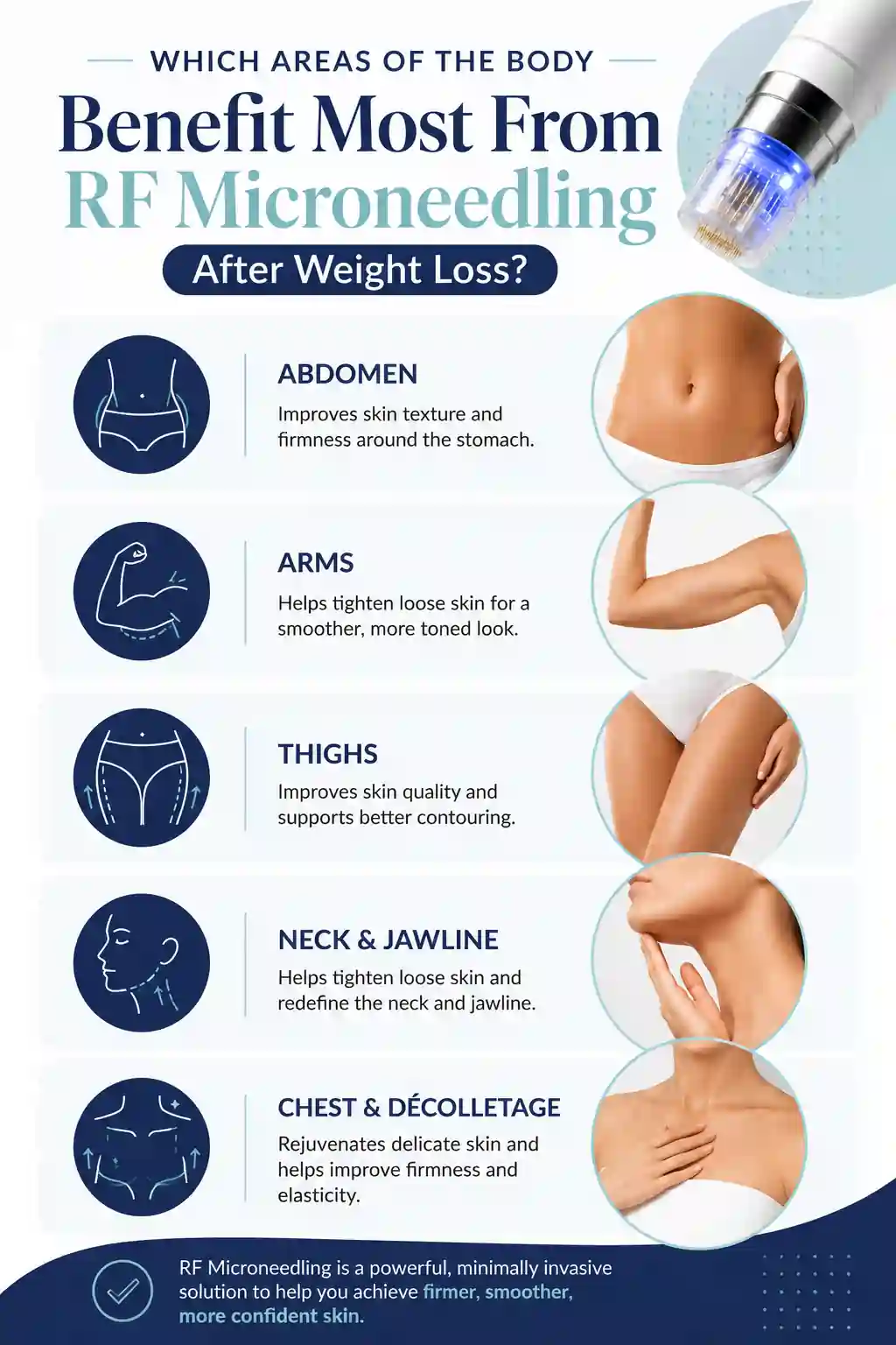 Which Areas of the Body Benefit Most From RF Microneedling After Weight Loss Ellesmere Port